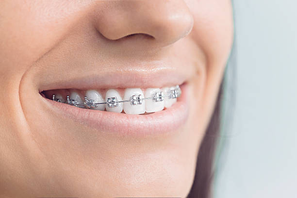 Best Full Mouth Reconstruction  in Arnold, MD